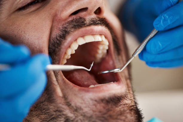 Best Emergency Orthodontic Repairs in Clarksburg, MD