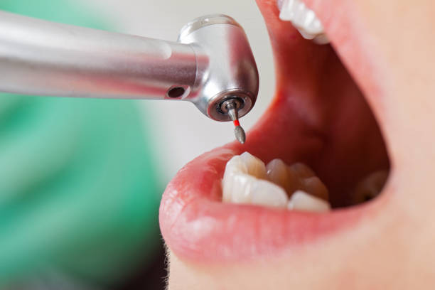 Best Emergency Denture Repair in Clarksburg, MD